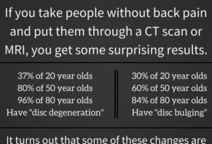 Stats for CT scan or MRI