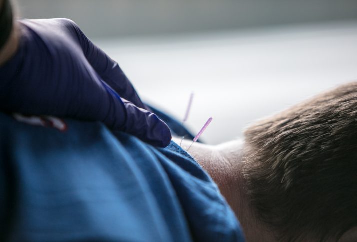 Male patient receiving dry needling